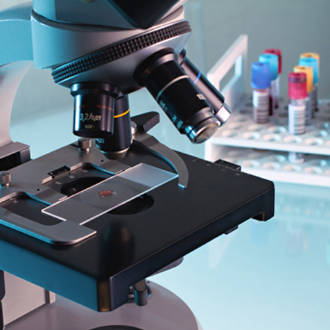 Blood sample being checked under microscope
